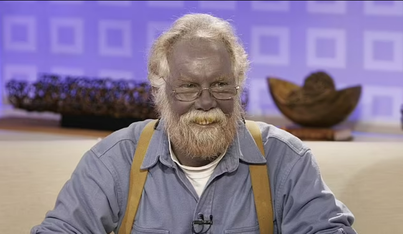 Мир захватывает новый косметологический тренд, от которого можно умереть: в чем опасность